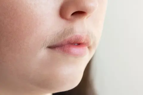 Skuteczne metody, jak pozbyć się wąsika damskiego bez bólu i podrażnień