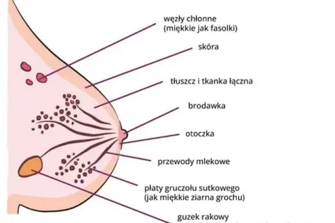 Czy rak piersi jest groźny? Poznaj statystyki, objawy i ryzyko zdrowotne